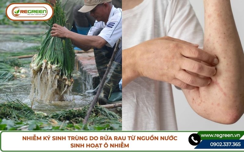 Ký sinh trùng lây lan qua vùng ô nhiễm nước thải sinh hoạt.